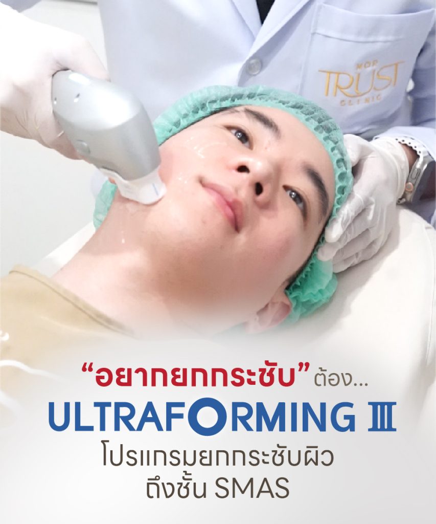 Ultraformer III