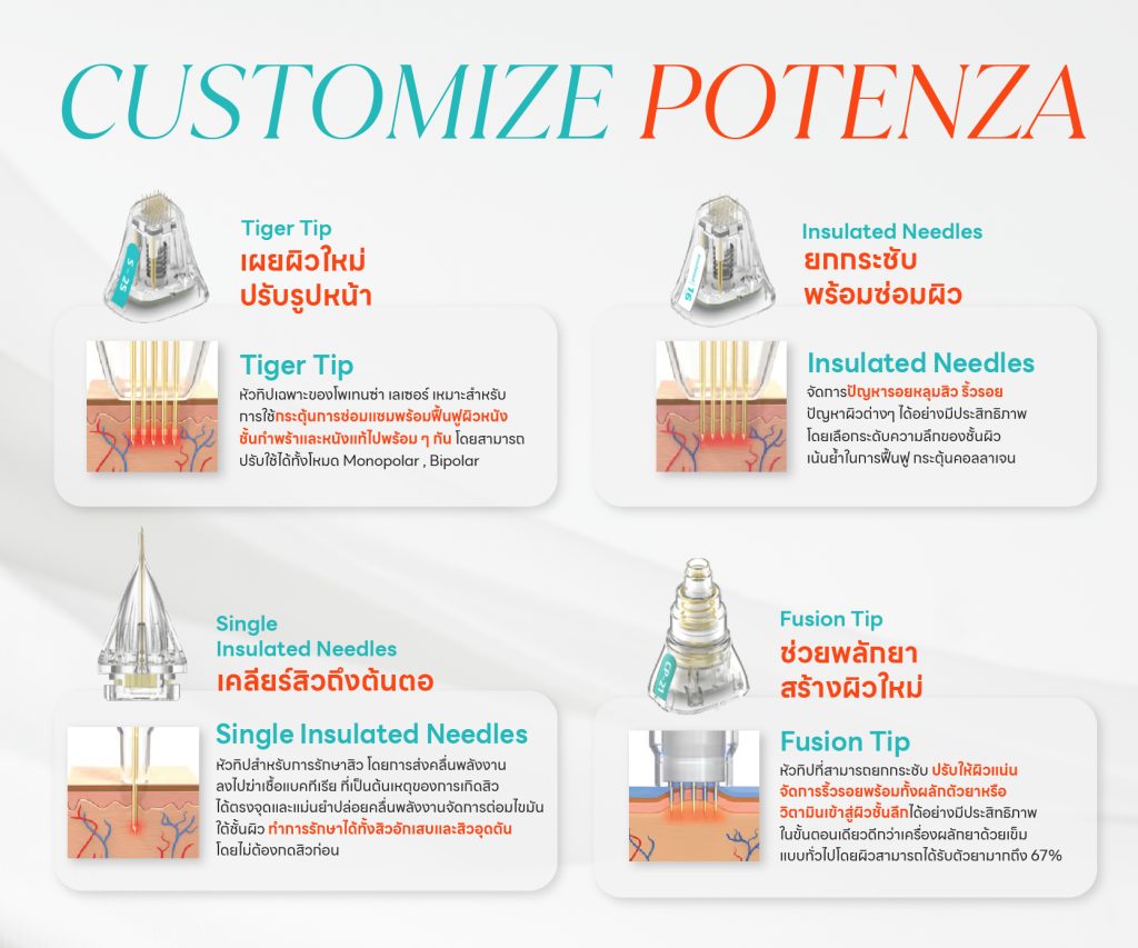 Potenza เหมาะกับใคร