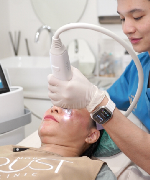 โปรแกรม Potenza Laser ดียังไง