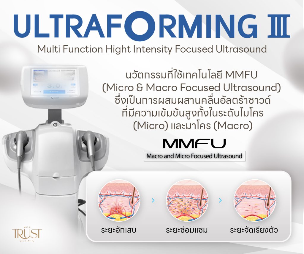 Ultraformer III