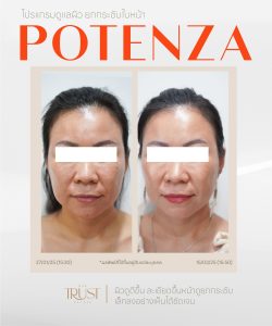 Potenza คุ้มไหม