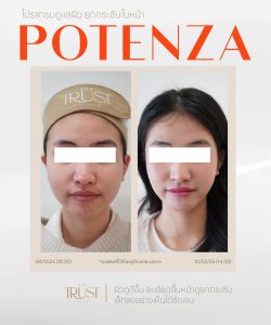 Potenza คุ้มไหม