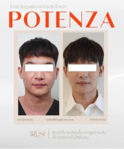 Potenza คุ้มไหม