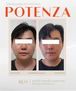 Potenza คุ้มไหม