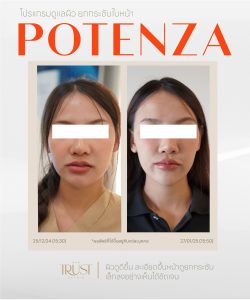 Potenza คุ้มไหม