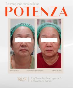 Potenza คุ้มไหม