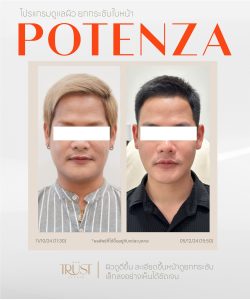 Potenza คุ้มไหม