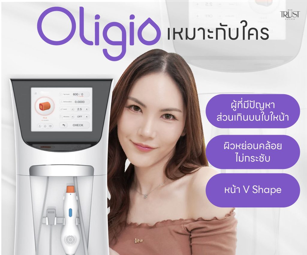 Oligio เหมาะกับใคร