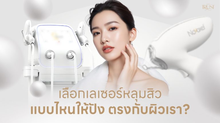 เลเซอร์หลุมสิวเชียงใหม่ เลือกแบบไหนให้ปัง ให้ตรงกับผิวเรา?