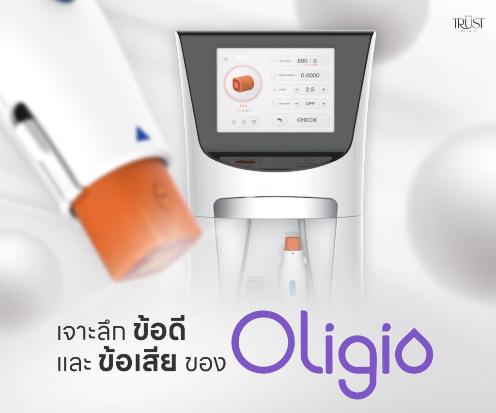 ข้อดี ข้อเสียของการทำ Oligio
