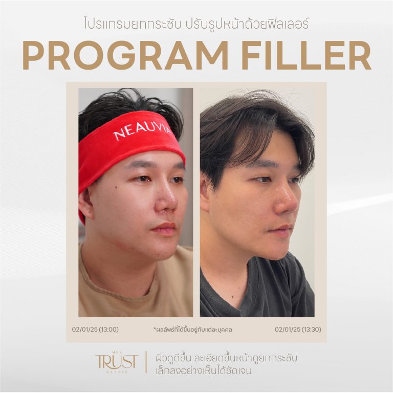 Filler01