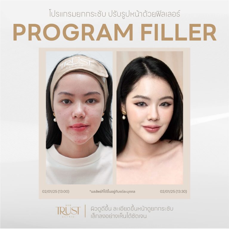 Filler03