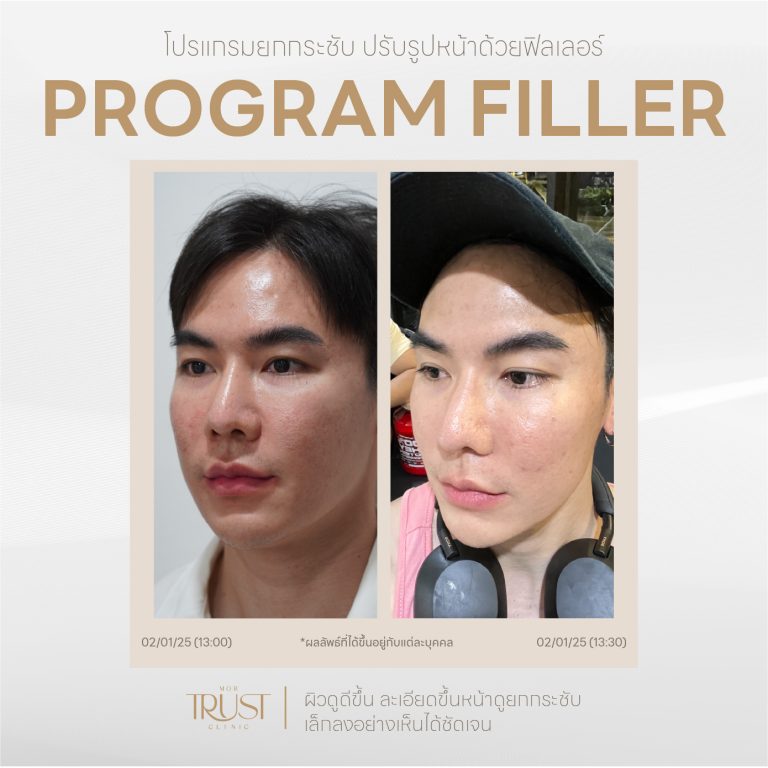 Filler04