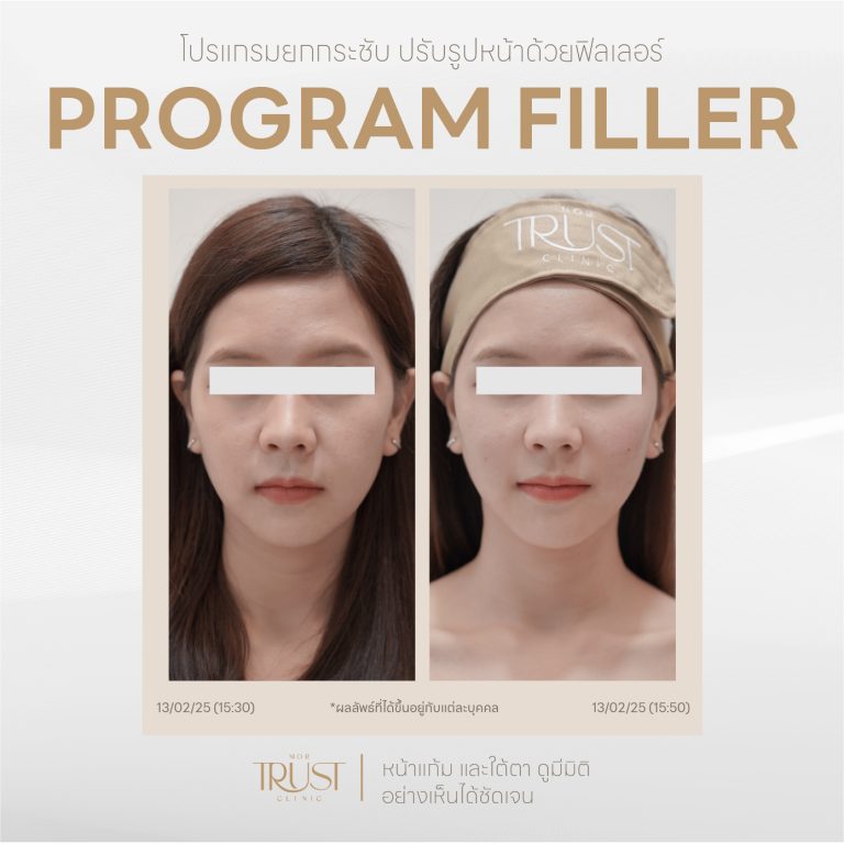 Filler05