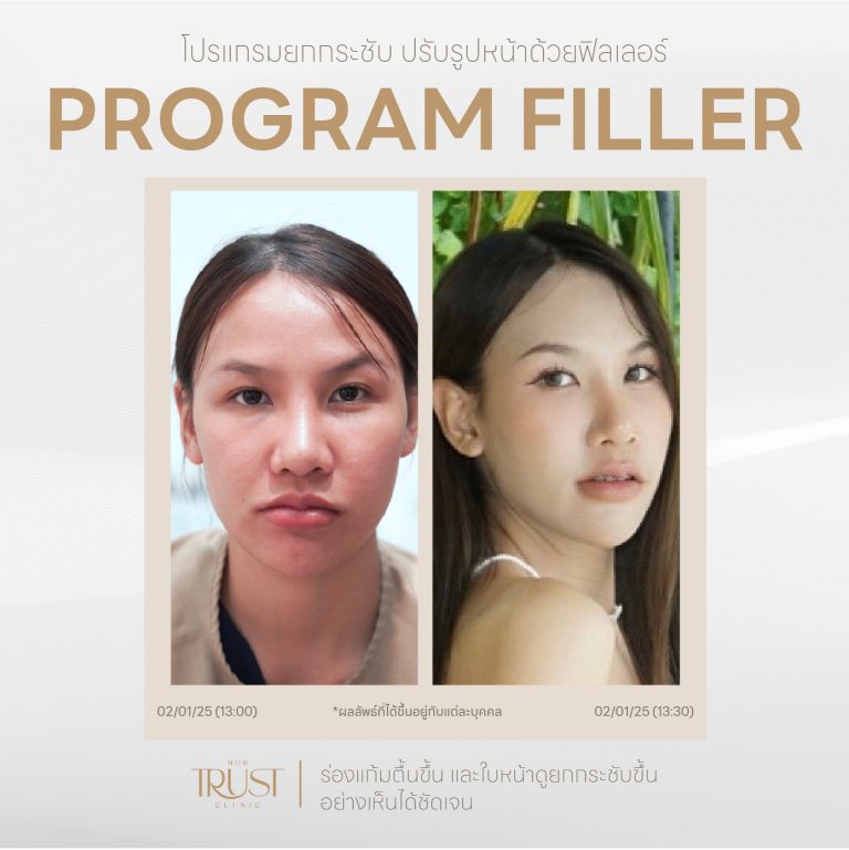 Filler06