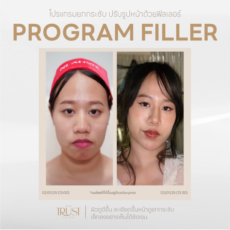 Filler07