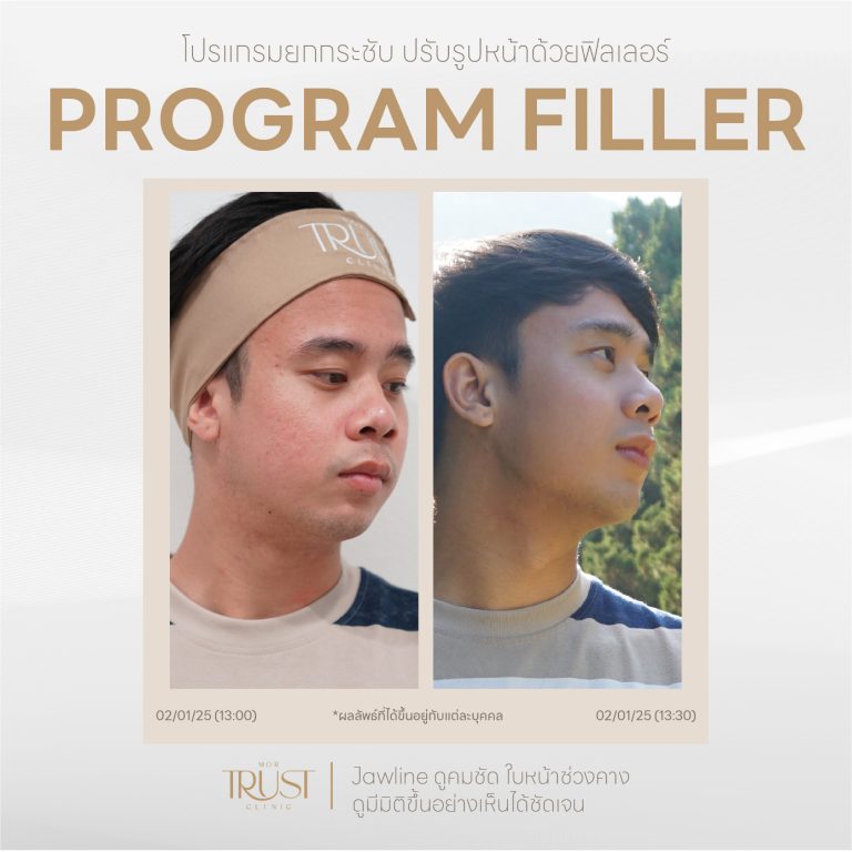 Filler08