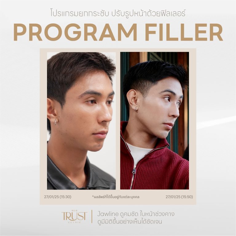 Filler09