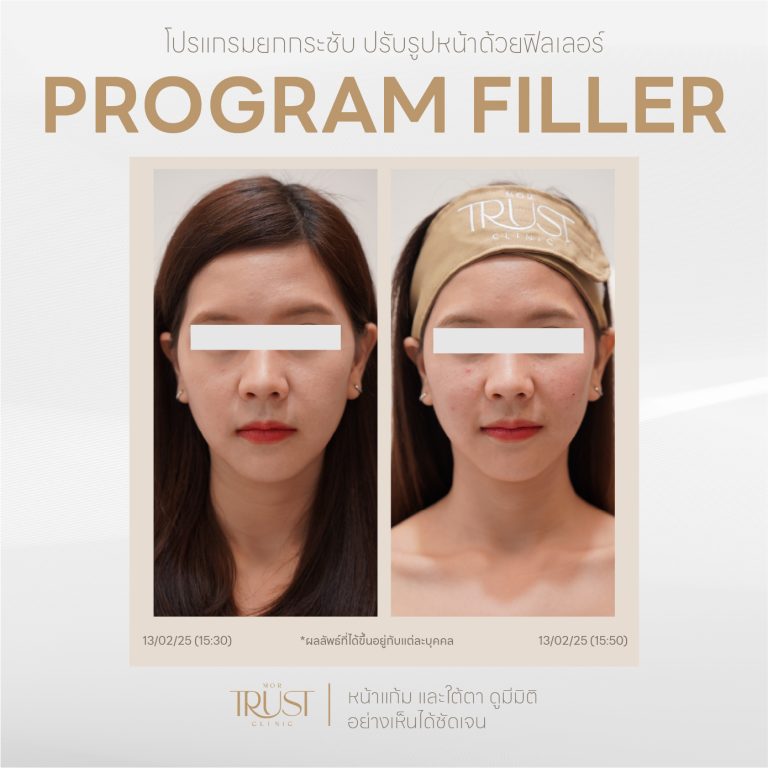 Filler11
