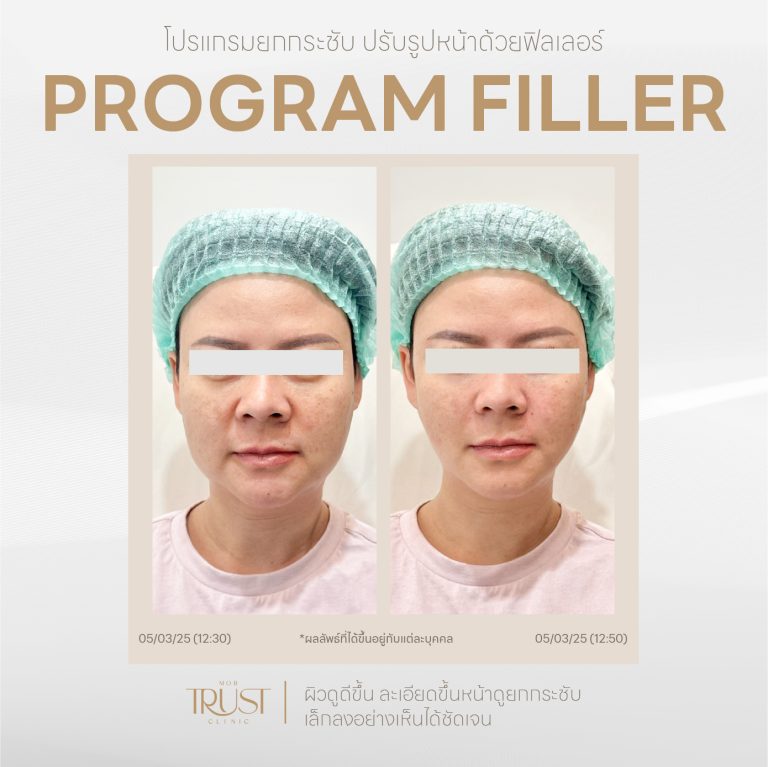 Filler13