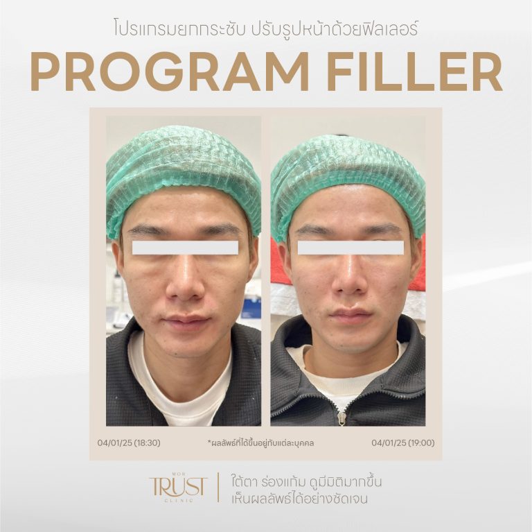 Filler16