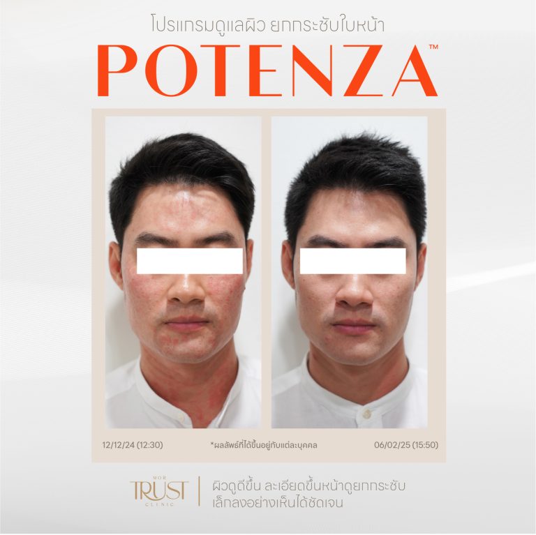 Potenza04