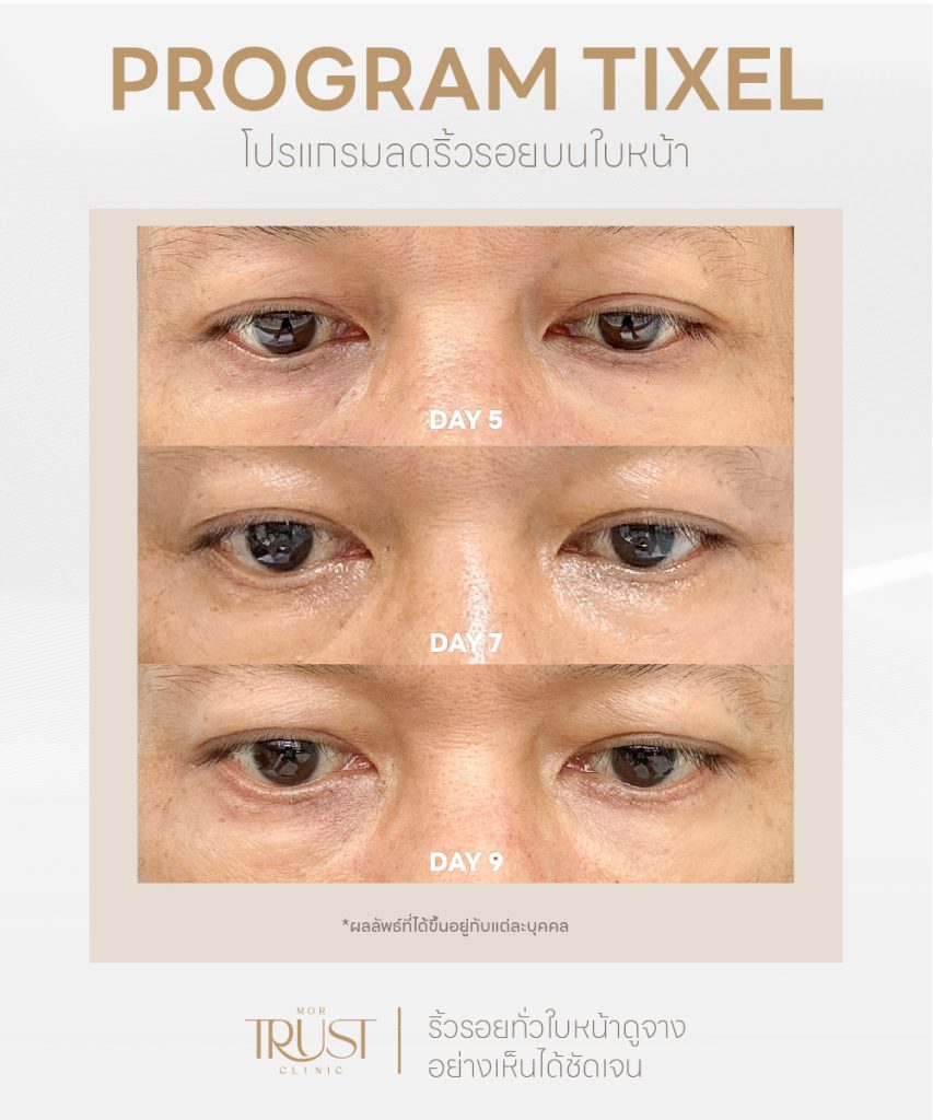 mortrustclinic