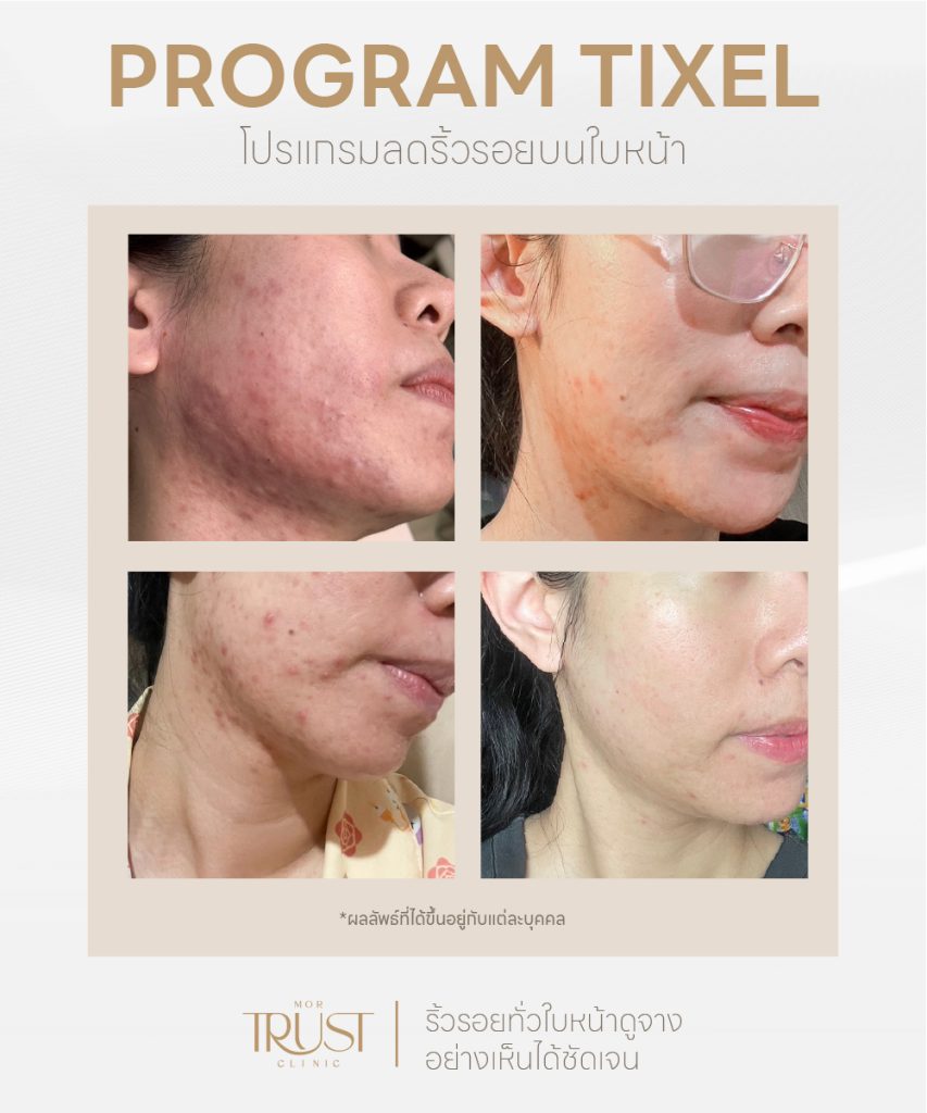 mortrustclinic
