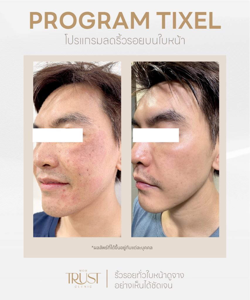 mortrustclinic