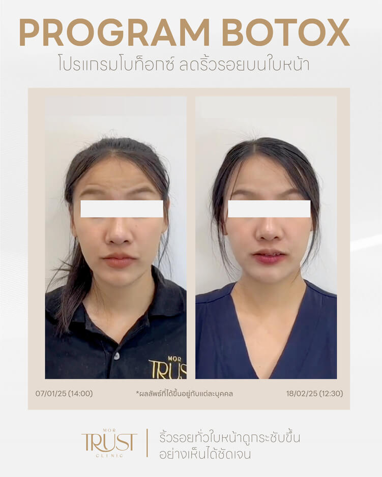 รูปรีวิว5