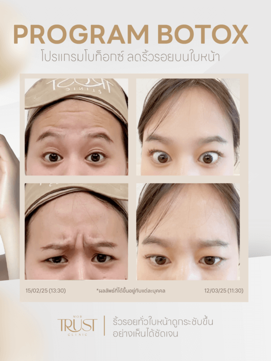 รูปรีวิว1
