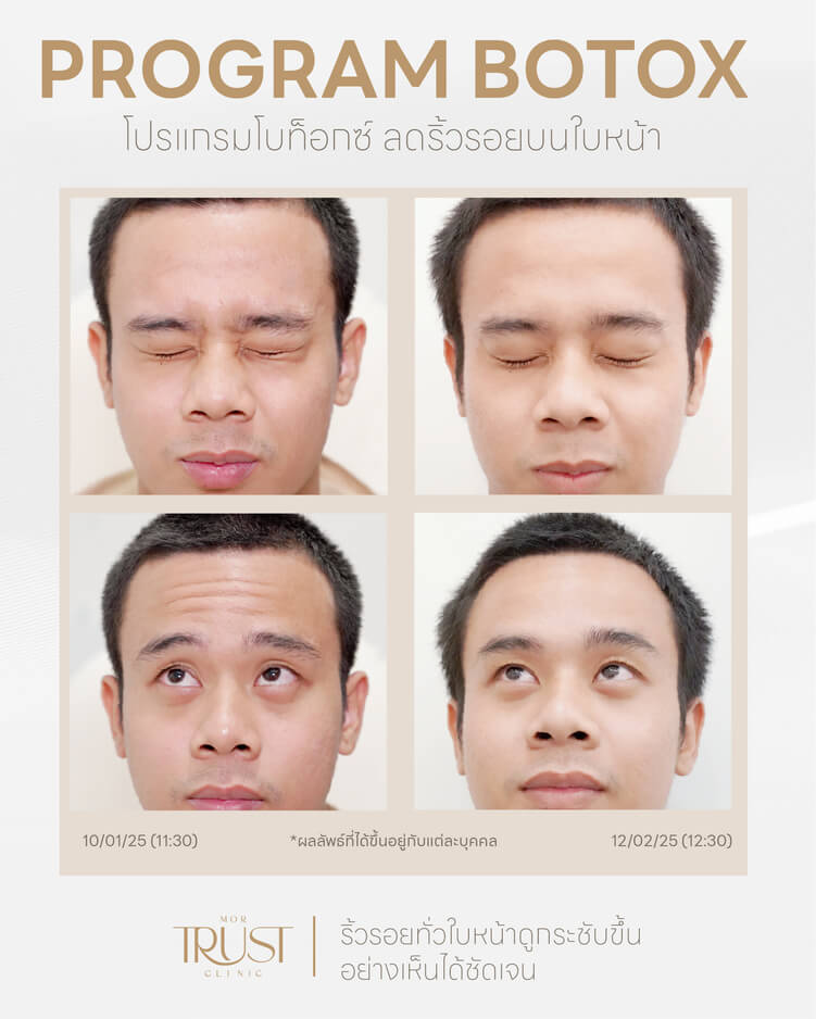 รูปรีวิว2