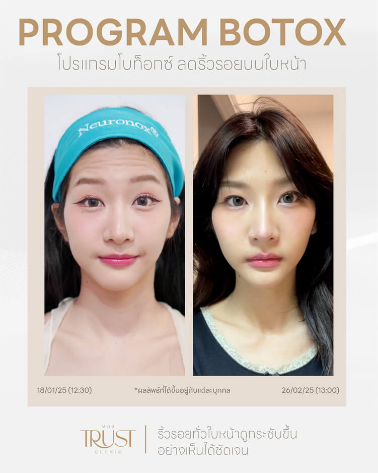 รูปรีวิว4
