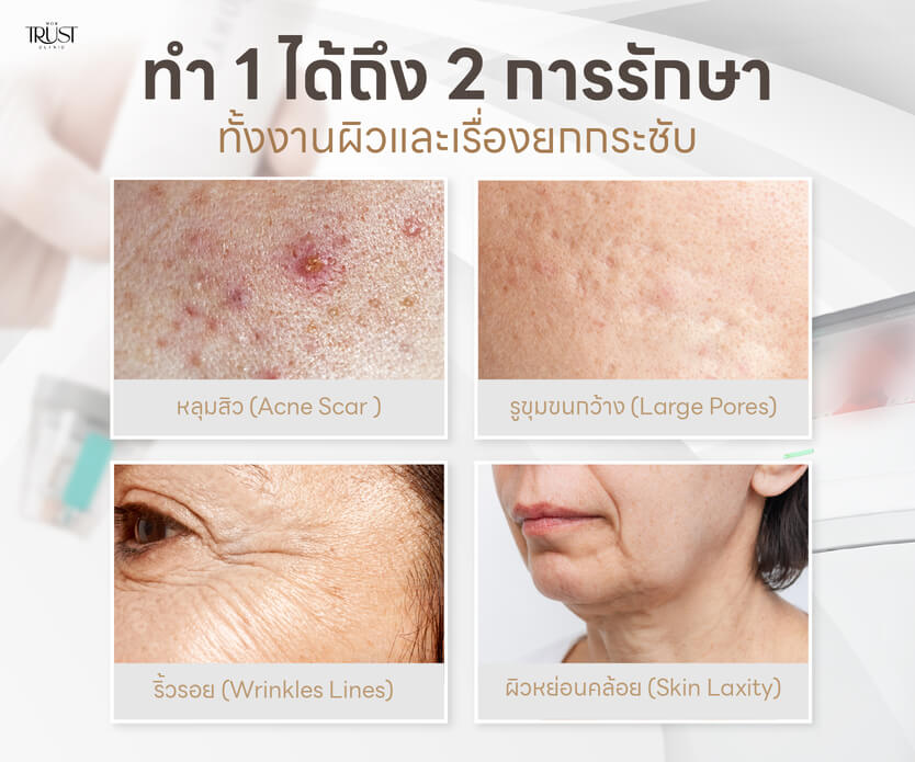 Potenza ราคาขึ้นอยู่กับอะไร