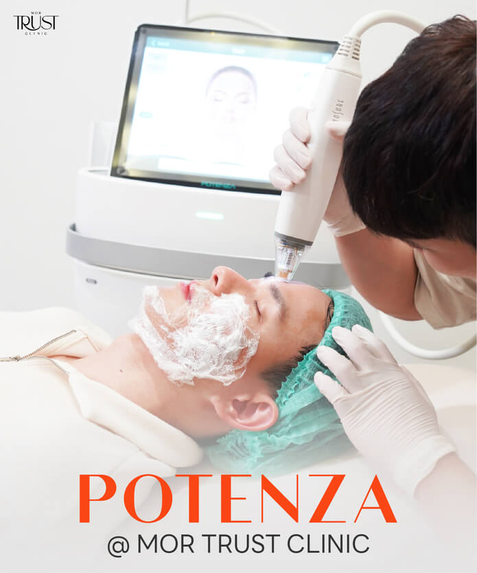 Potenza ที่ Mor Trust Clinic