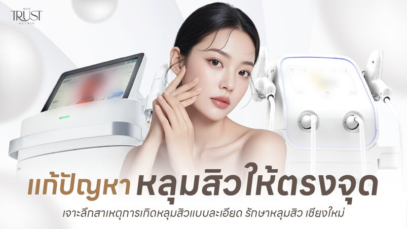 รักษาหลุมสิว เชียงใหม่