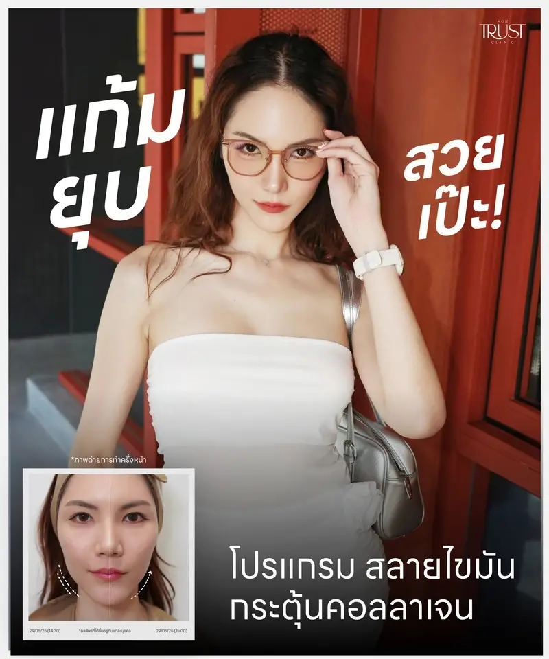 บริเวณที่เหมาะสมในการรักษา