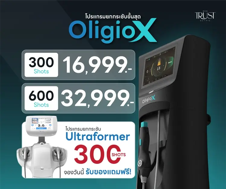 Oligio X ราคาเท่าไหร่