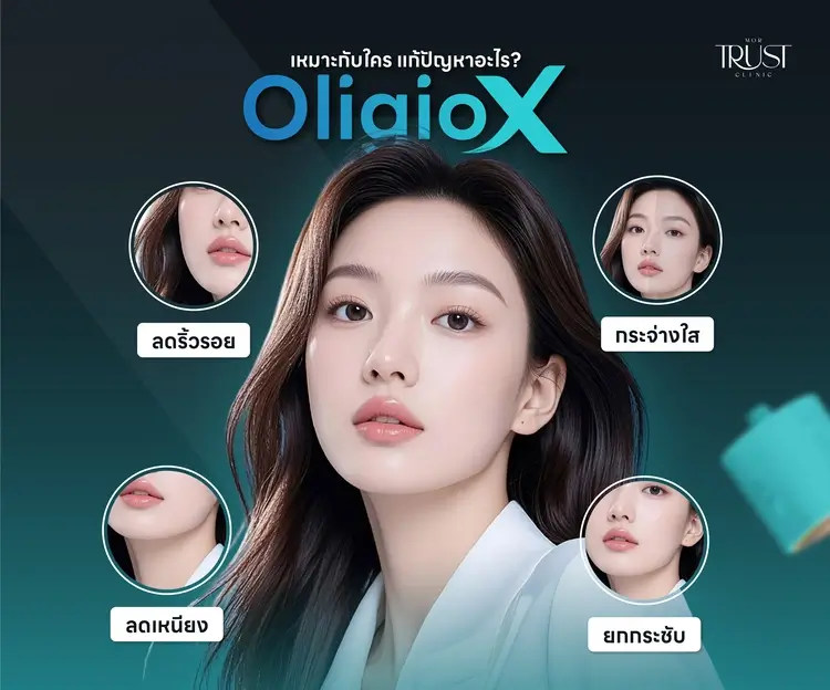 Oligio X เหมาะกับใคร