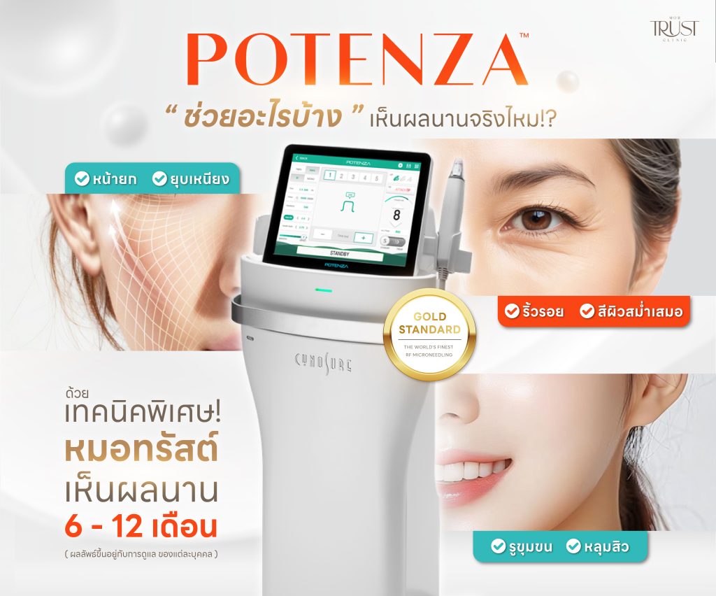 Potenza ลดริ้วรอย