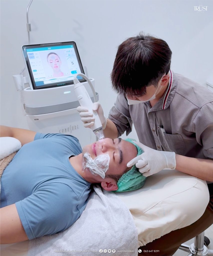 Potenza รีวิวยกกระชับ