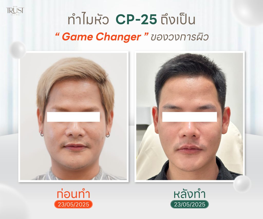 Potenza หัว CP-25