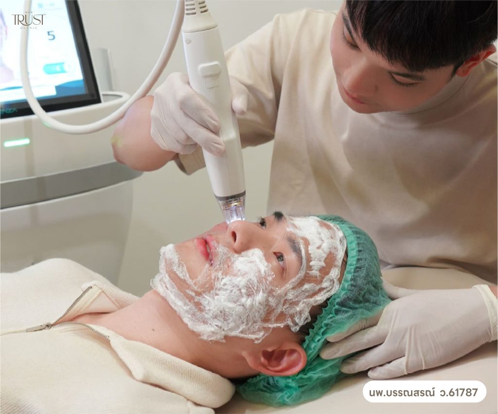 Potenza vs เลเซอร์ รอยสิว