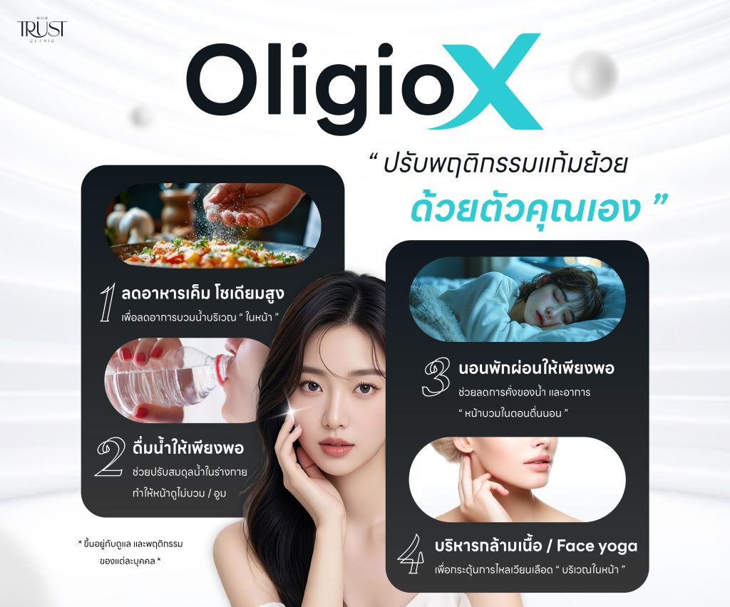 Oligio X วิธีลดแก้ม