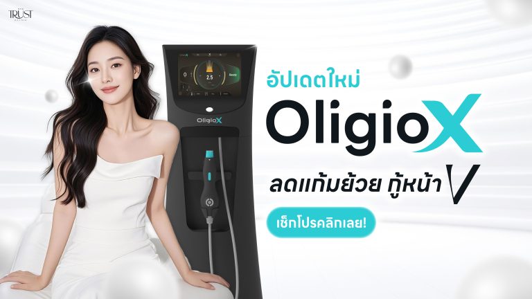 5 วิธีลดแก้ม จัดการกระเปาะแก้มห้อยให้อยู่หมัด! พร้อมเจาะลึก Oligio X นวัตกรรมใหม่